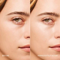 Brightening Eye Gel for Dark Circles