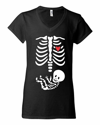 BABY XRAY | T-Shirt Time