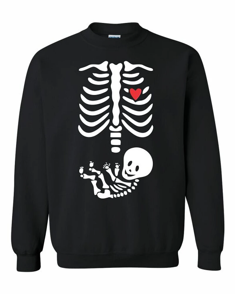 BABY XRAY | T-Shirt Time